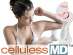 ��������������� ��������� �������� Cellules MD
